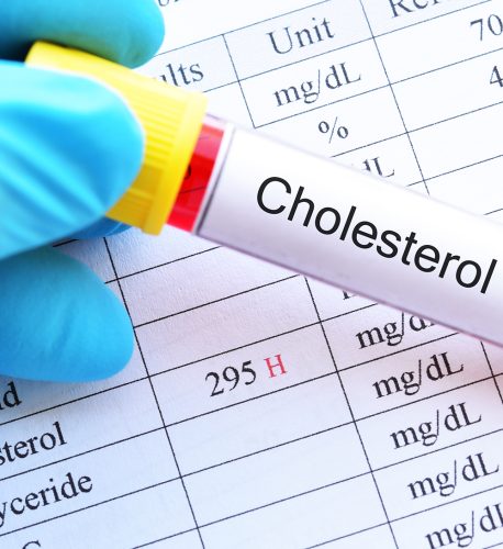kolestrol